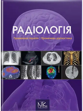 Радіологія. Променева терапія. Променева діагностика. 2-ге видання. Ковальський О. В. та ін.