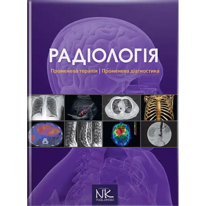 Радіологія. Променева терапія. Променева діагностика. 2-ге видання. Ковальський О. В. та ін.