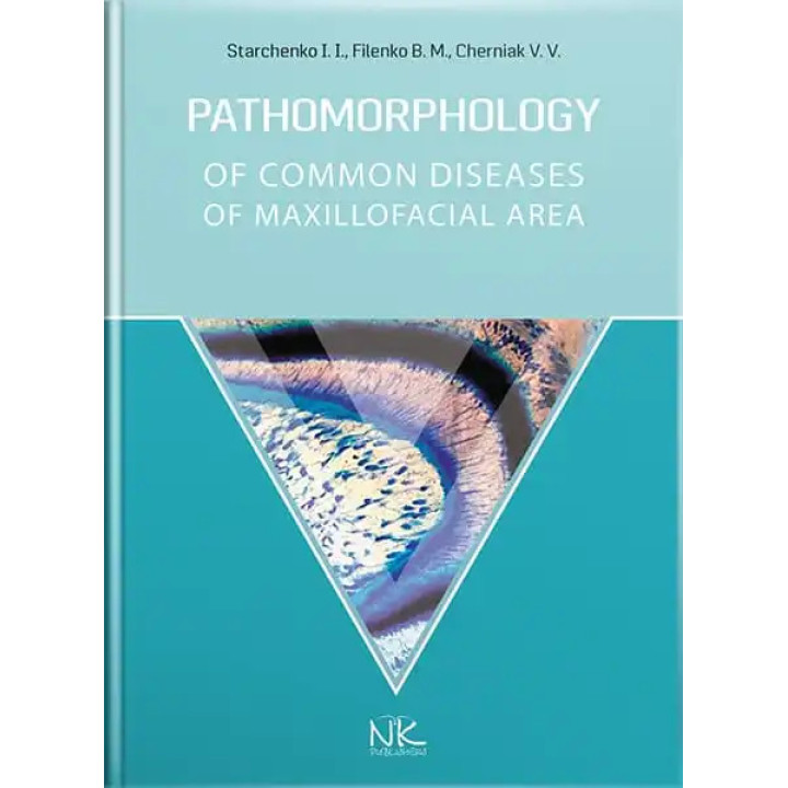 Pathomorphology of Сommon Diseases of Maxillofacial Area. Starchenko I. I., Filenko B. M., Cherniak V. V.