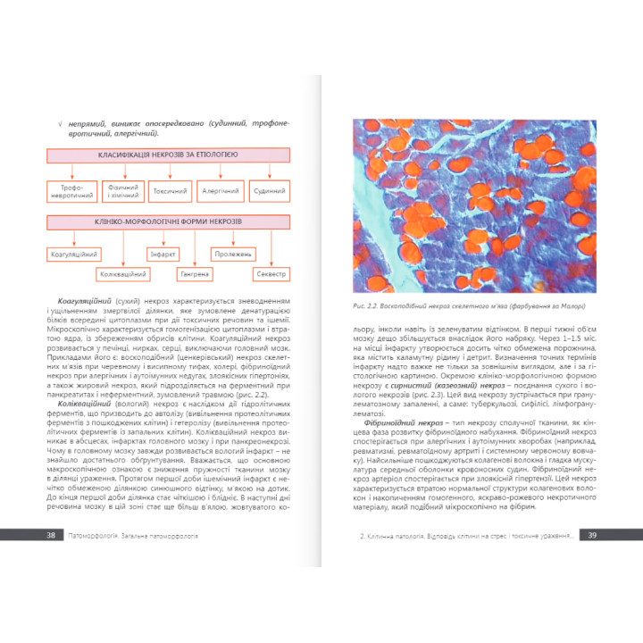 Патоморфологія. Загальна патоморфологія. Боднар Я. Я. та ін.