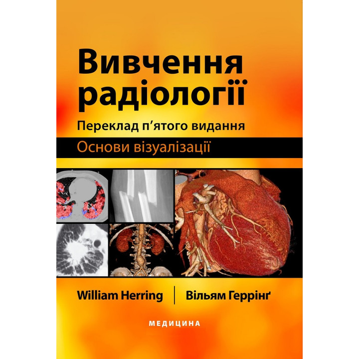 Вивчення радіології: основи візуалізації: 5-е видання. Вільям Геррінг