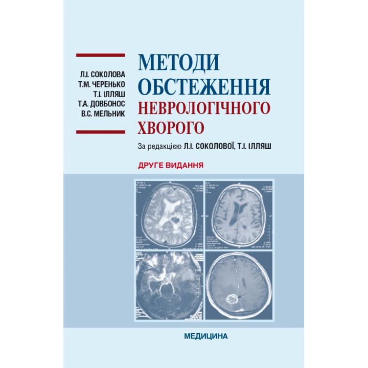 Методи обстеження неврологічного хворого. 2-е видання