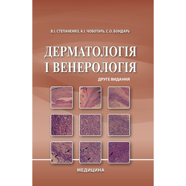 Дерматологія і венерологія. 2-е видання