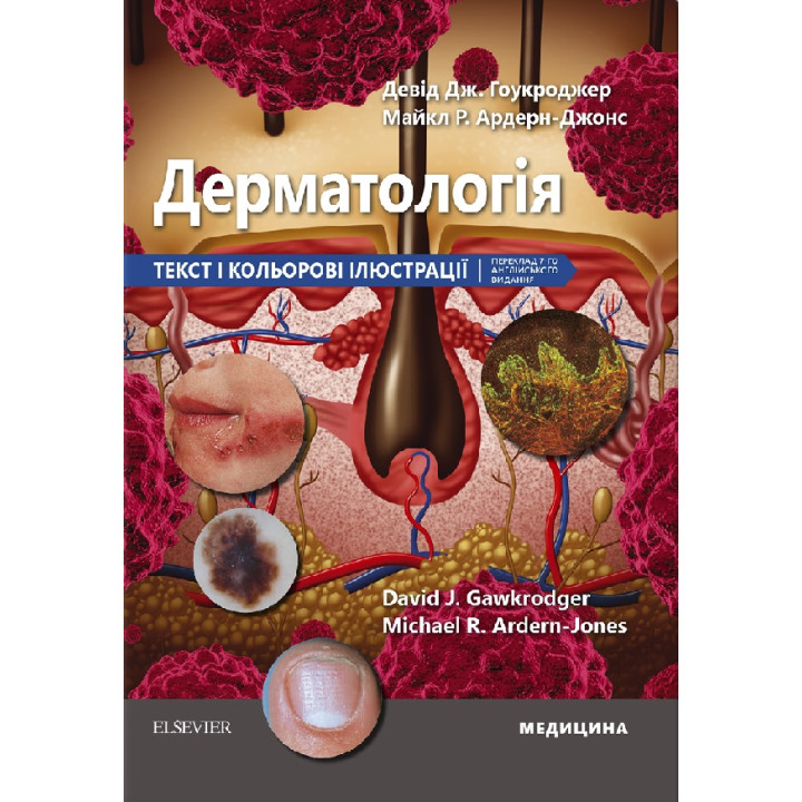 Дерматологія: текст і кольорові ілюстрації: 7-е видання. Девід Дж. Гоукроджер, Майкл Р. Ардерн-Джонс