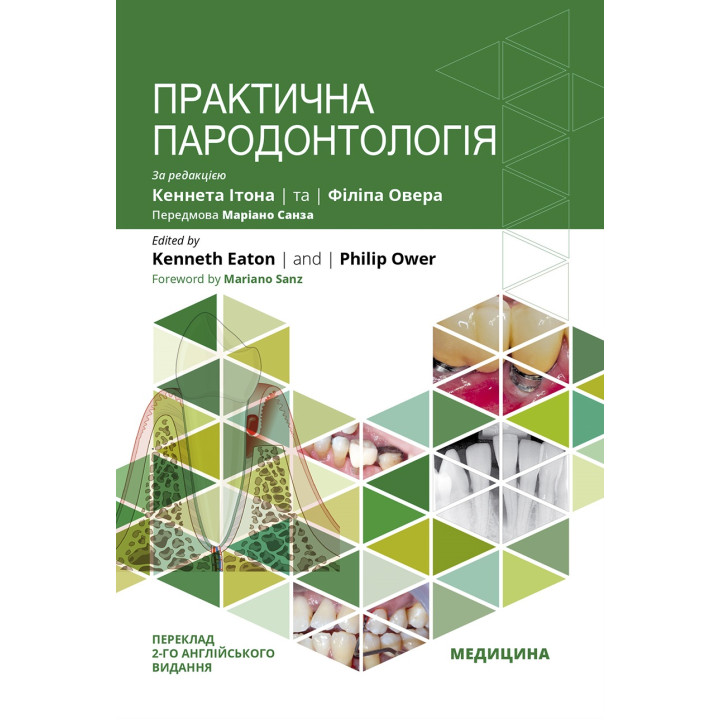 Практична пародонтологія. 2-е видання. Кеннет Ітон, Філіп Овер