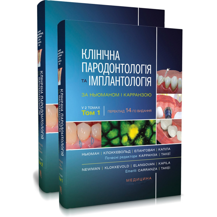 Клінічна пародонтологія та імплантологія за Ньюманом і Карранзою: 14-е видання: в 2-х томах