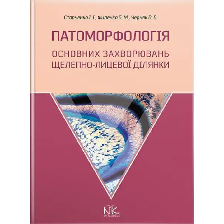 Патоморфологія основних захворювань щелепно-лицьової ділянки. Старченко І.І., Філенко Б.М. та ін.