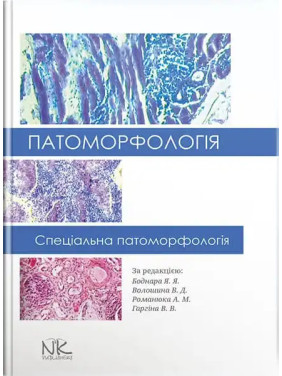 Патоморфологія. Спеціальна патоморфологія. Боднар Я. Я., Волошина В. Д., Романюк А. М., Гаргіна В. В. (за ред.)